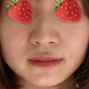 エイペックス美容外科口コミ