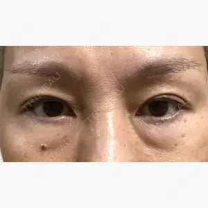 ヨーダー公子クリニック眼科・美容皮膚科 横浜六浦院口コミ