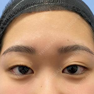 湘南美容クリニック 西葛西院口コミ