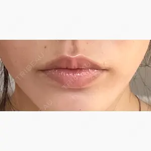 ナチュレ美容クリニック口コミ