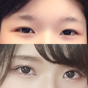 ツツイ美容外科口コミ