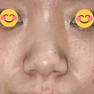 ヒルズ美容クリニック口コミ