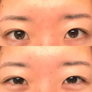 エイペックス美容外科口コミ