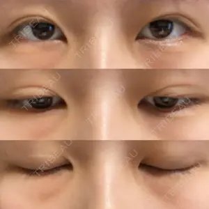 リビジョンクリニック（旧：池本形成外科・美容外科）口コミ