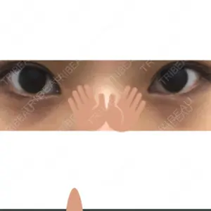 Wクリニック 梅田院口コミ