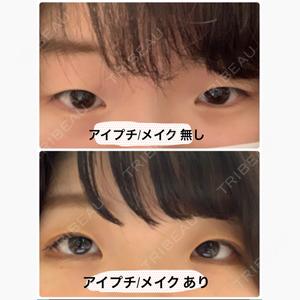 湘南美容クリニック 新潟院口コミ