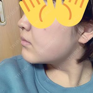 湘南美容クリニック 新潟院口コミ