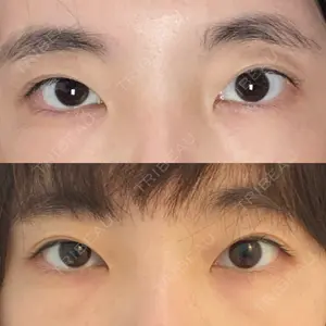 品川美容外科 梅田院口コミ