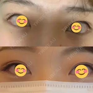 品川美容外科 大宮院口コミ