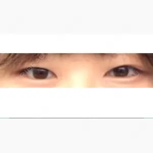 共立美容外科 大宮院口コミ