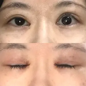 東京皮膚科・形成外科 (銀座いけだクリニック)口コミ