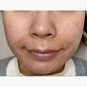 有楽町美容外科クリニック口コミ