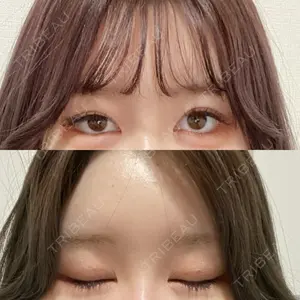 CLASSY 仙台美容外科・美容皮膚科口コミ