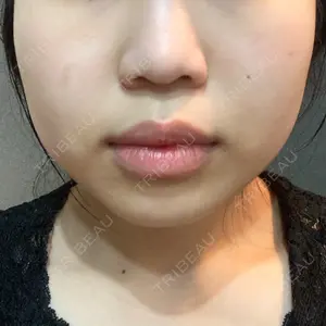 品川スキンクリニック広島院口コミ