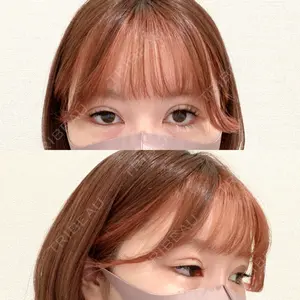 CLASSY 仙台美容外科・美容皮膚科口コミ