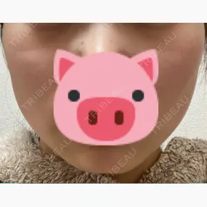 アサミ美容外科 渋谷院口コミ