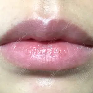 Wクリニック 心斎橋院口コミ