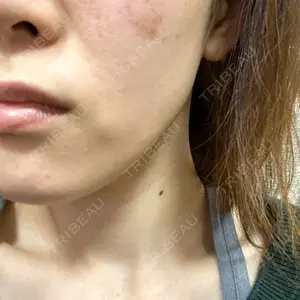 JMスマイルクリニック口コミ