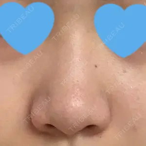 エイペックス美容外科口コミ