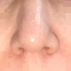 品川美容外科 梅田院口コミ