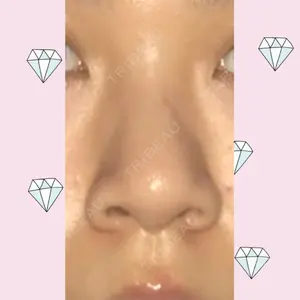 ヴェリテクリニック 大阪院口コミ