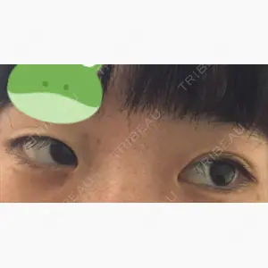 共立美容外科 神戸三宮院口コミ