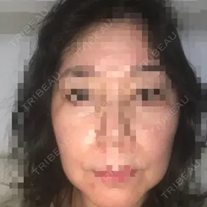 品川美容外科 梅田院口コミ