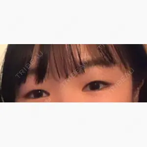 CLASSY 仙台美容外科・美容皮膚科口コミ