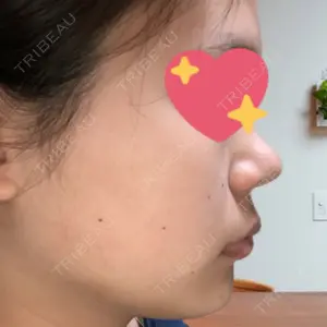 品川スキンクリニック岡山院口コミ