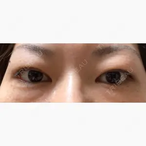 ツツイ美容外科口コミ