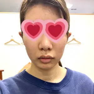 あつぎ美容クリニック口コミ