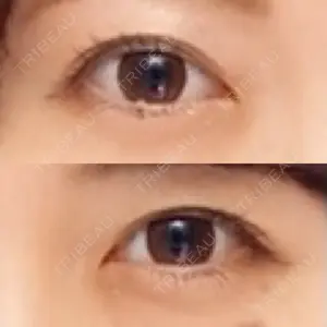 銀座高須クリニック口コミ