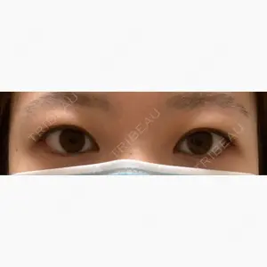 高須クリニック 大阪院口コミ