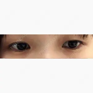 品川美容外科 名古屋院口コミ