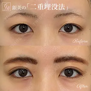 銀座美容外科クリニック 銀座院の症例