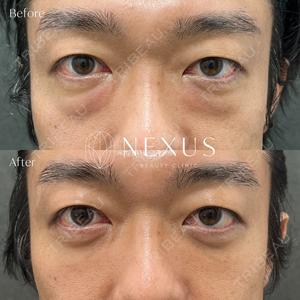 NEXUS CLINICの症例