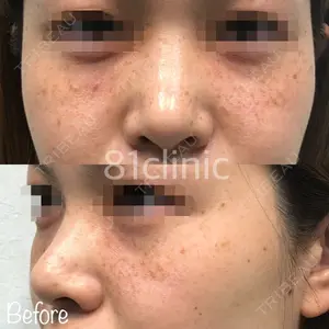 81clinicの症例