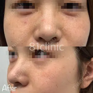 81clinicの症例