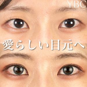 YBC横浜美容外科 池袋院 磯村 亮輔医師の症例