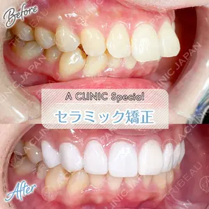 東京銀座A CLINIC デンタルの症例