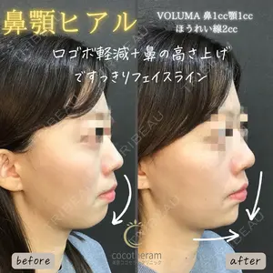 東京ココセランクリニック 篠﨑 智公医師の症例