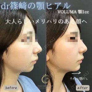 東京ココセランクリニック 篠﨑 智公医師の症例