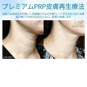 聖心美容クリニック 六本木院の症例