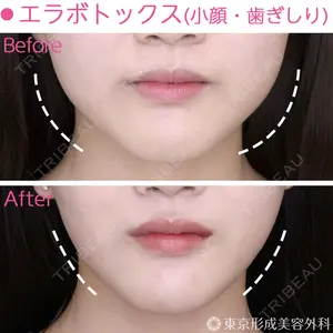 東京形成美容外科 船橋院 山崎 修吾医師の症例