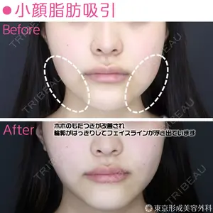 東京形成美容外科 船橋院 山崎 修吾医師の症例