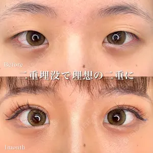 東京シンデレラ美容外科 池袋院の症例