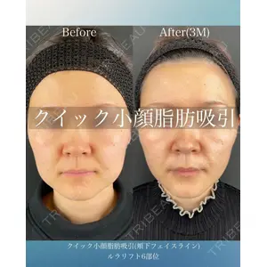 ルラ美容クリニック 大阪本院 平田 一記医師の症例