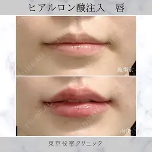LA CLEF CLINIC（ラクレクリニック） 佐々木 健一郎医師の症例