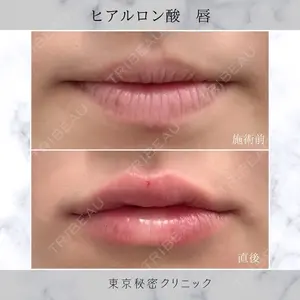 LA CLEF CLINIC（ラクレクリニック） 佐々木 健一郎医師の症例