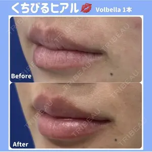 湘南美容クリニック 銀座院の症例